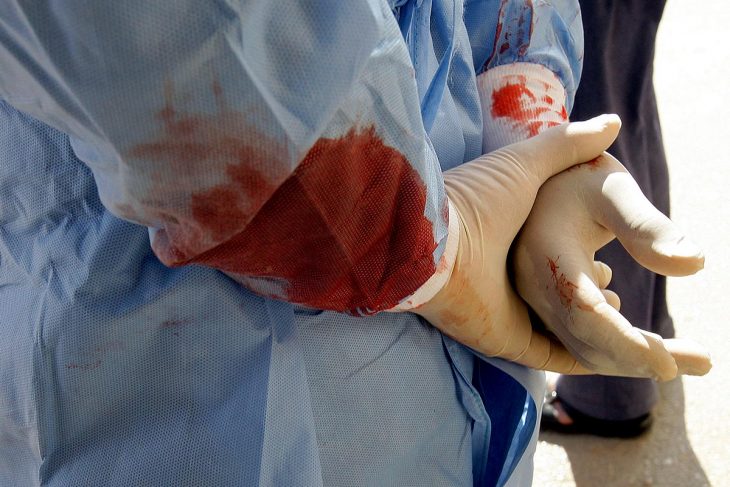 Les mains d'un médecin syrien dont la blouse est tâchée de sang