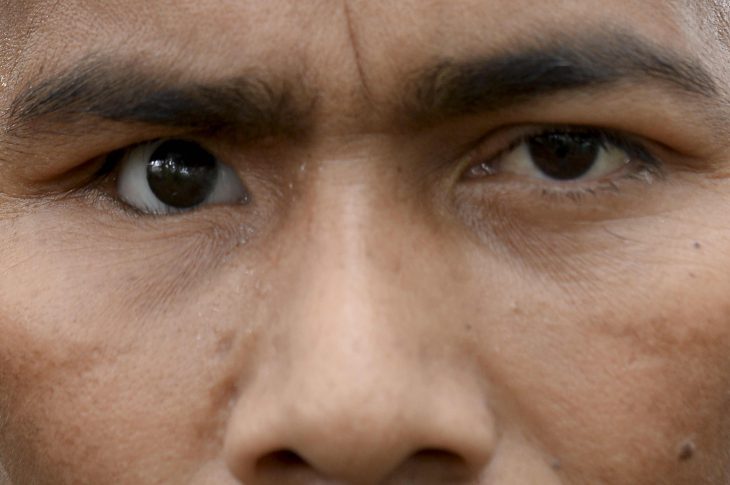 Colombie: les guérilleros des Farc, leurs cicatrices et celles des autres